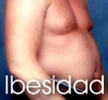 bespe_obesidad1.jpg